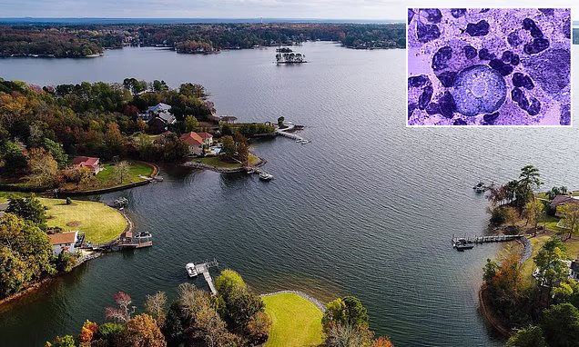Brain Eating Amoeba