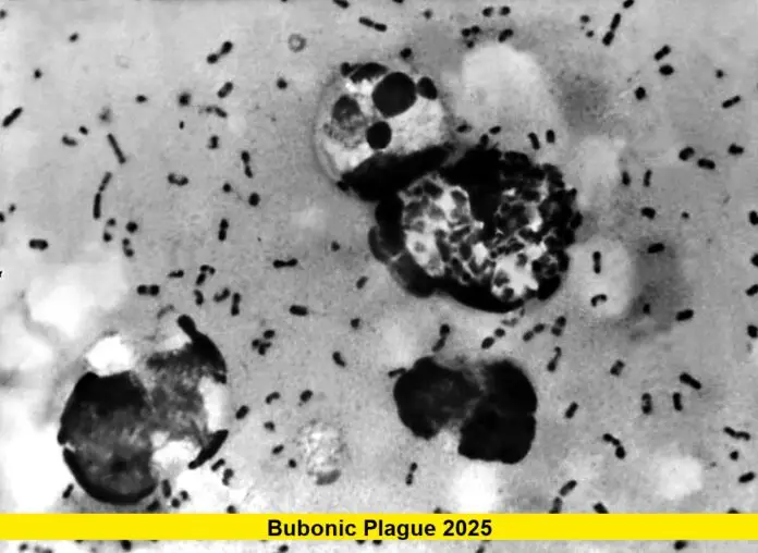 Bubonic Plague 2025