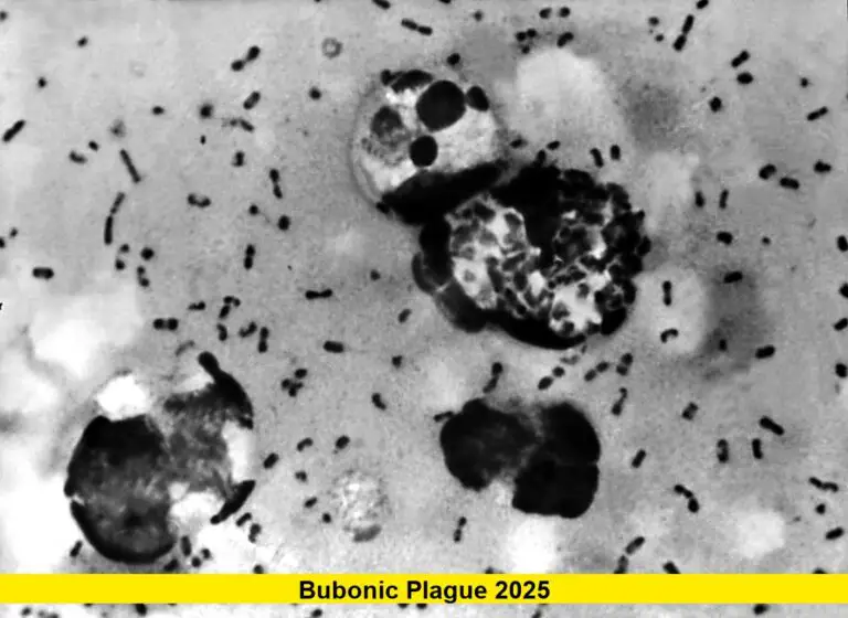 Bubonic Plague 2025
