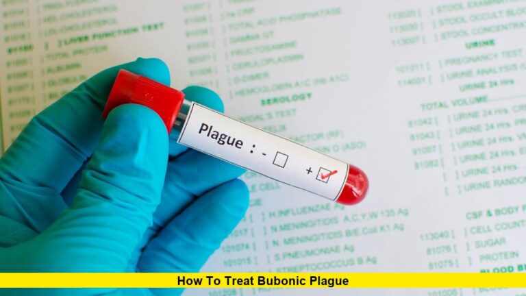 How to Treat Bubonic Plague