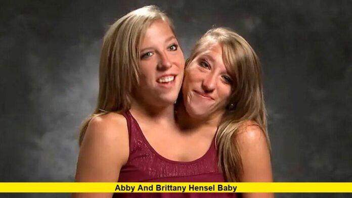 Abby and Brittany Hensel Baby