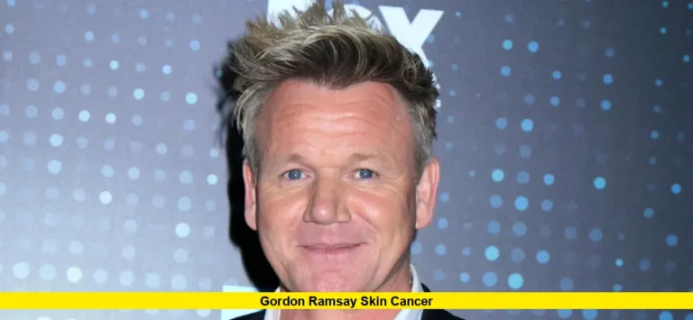 Gordon Ramsay Skin Cancer