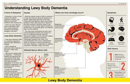 Lewy Body Dementia