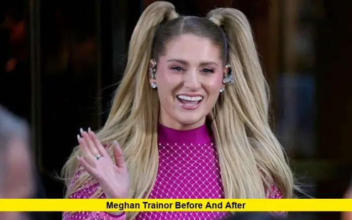 Meghan Trainor Before and After