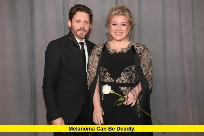 Melanoma Can Be Deadly
