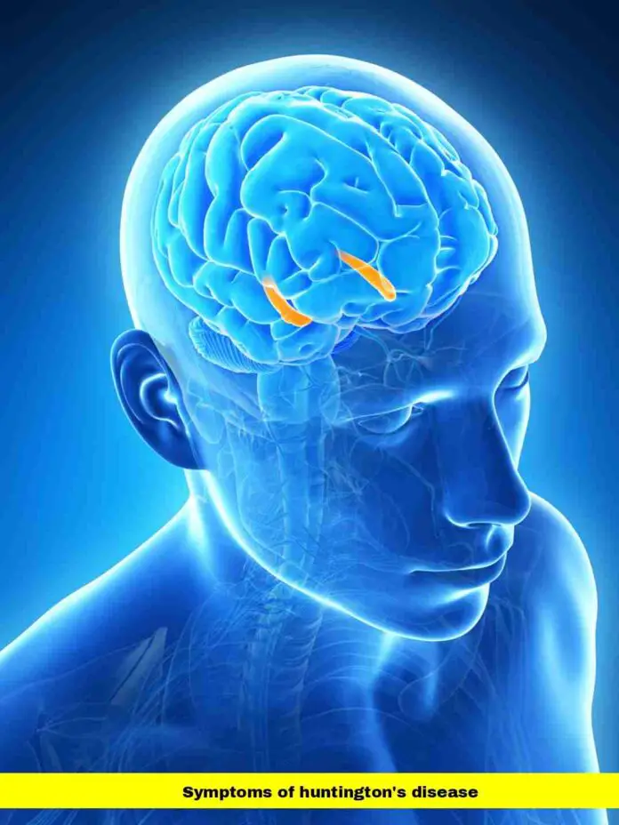 symptoms of huntington's disease
