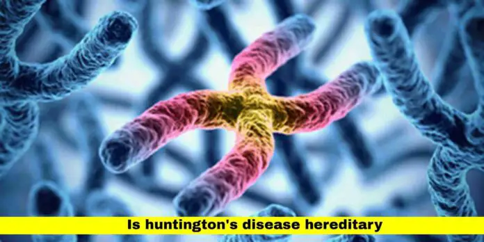 is huntington's disease hereditary