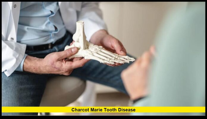 Charcot Marie Tooth Disease: New Research Brings Hope for Patients in 2025
