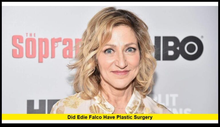 Did Edie Falco Have Plastic Surgery?