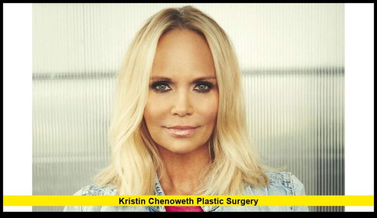Kristin Chenoweth Plastic Surgery: What We Know So Far (2025 Update)