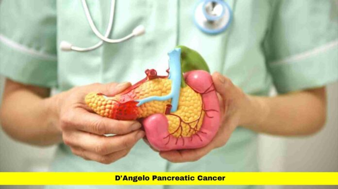 D'Angelo Pancreatic Cancer