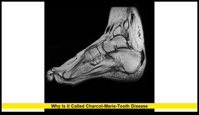 Why Is It Called Charcot-Marie-Tooth Disease Why Is It Called Charcot-Marie-Tooth Disease: The Story Behind the Name and Its Lasting Legacy