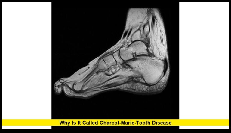 Why Is It Called Charcot-Marie-Tooth Disease: The Story Behind the Name and Its Lasting Legacy