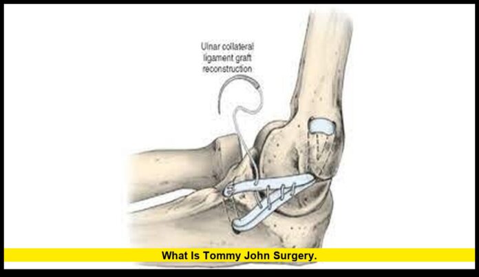 what is Tommy John surgery