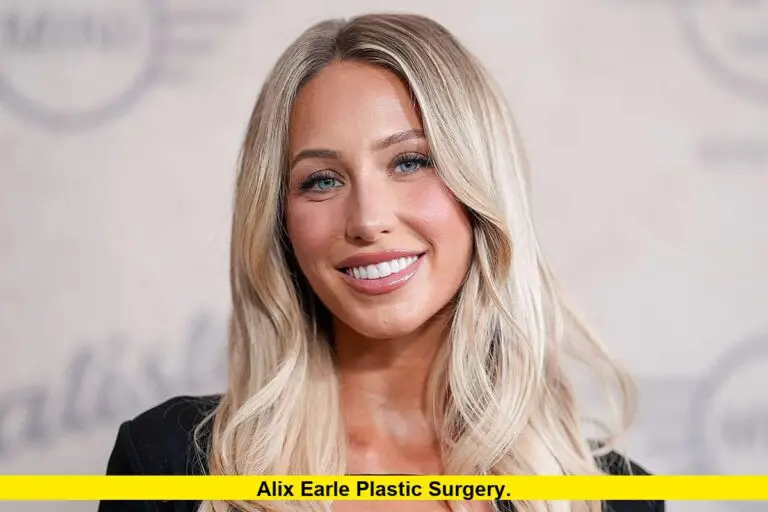 Alix Earle Plastic Surgery