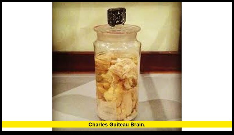 Charles Guiteau brain