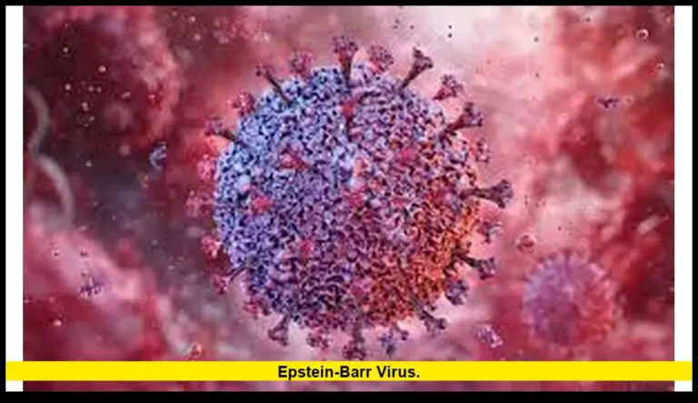 Epstein-Barr virus