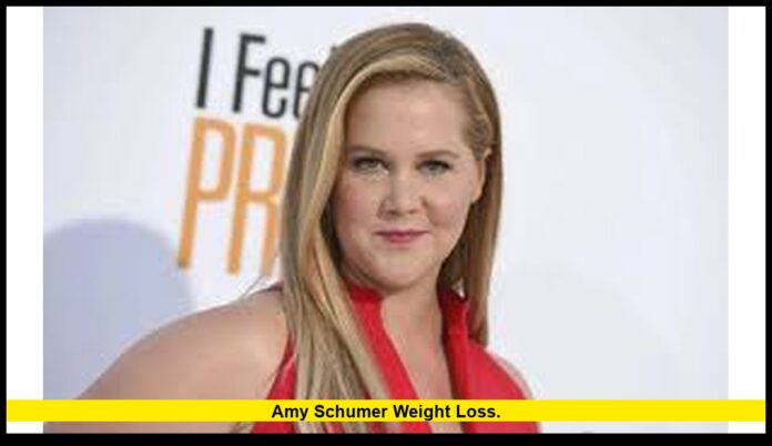 Amy Schumer weight loss. Amy Schumer weight loss.