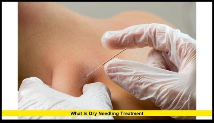 what is dry needling treatment